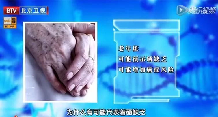 成年人缺硒怎么补快(成人缺硒有什么症状)-硒宝网