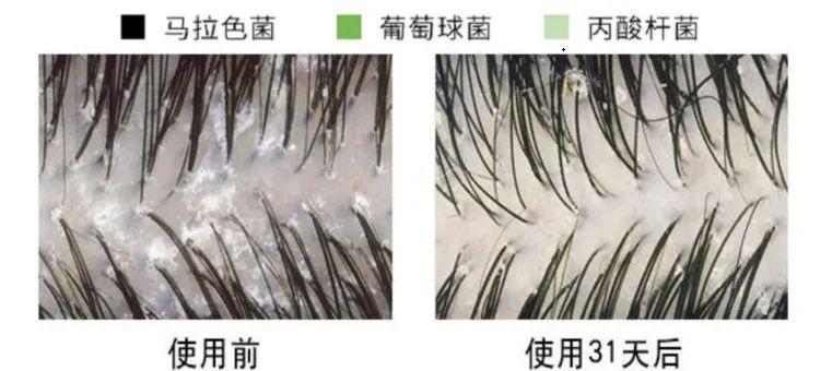 补哪款硒洗发水好呢（洗发水补充液是真的吗）-硒宝网