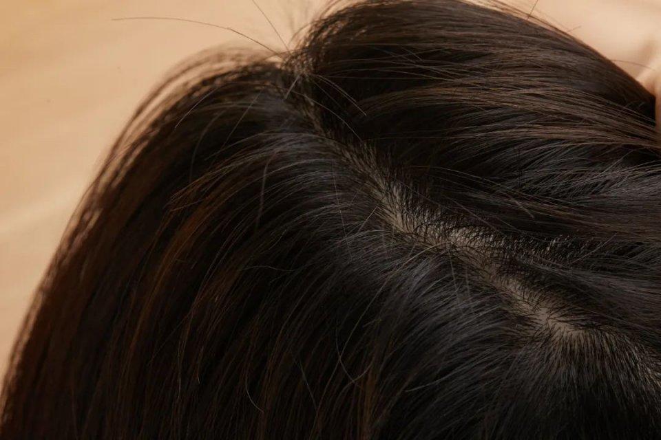 补哪款硒洗发水好呢（洗发水补充液是真的吗）-硒宝网