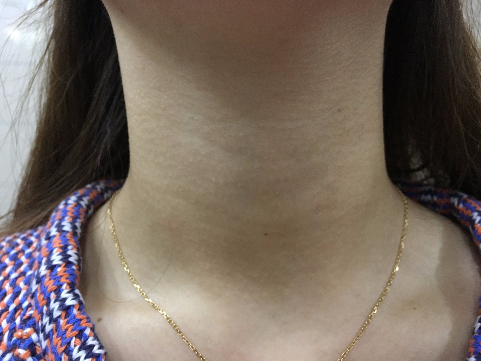 甲状腺术后补钙原则(术甲状腺原则补钙后注意什么)-硒宝网