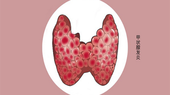 自身免疫病能补硒吗(免疫力低补硒有用吗)-硒宝网