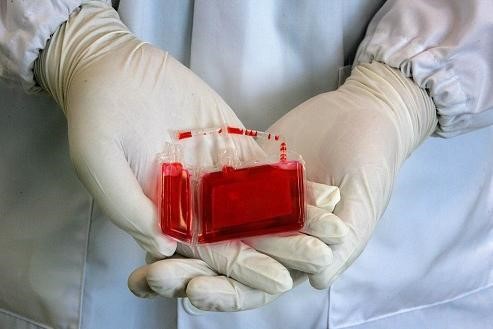 缺锰和硒要补什么钙（钙锰缺补硒要补多久）-硒宝网