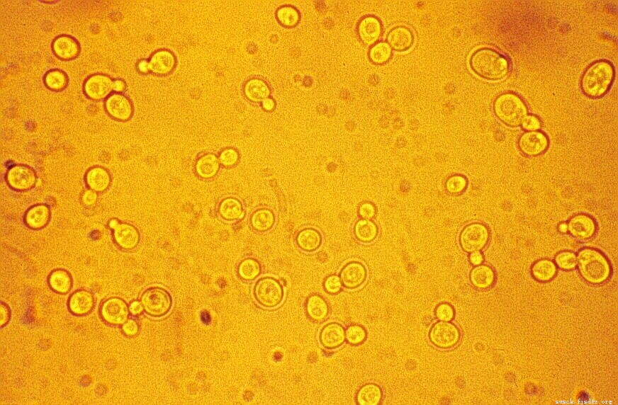哪9大人群需要补硒(需补硒的人群)-硒宝网
