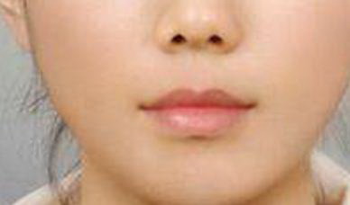 硒和锌哪个补黑色素（补锌硒）-硒宝网