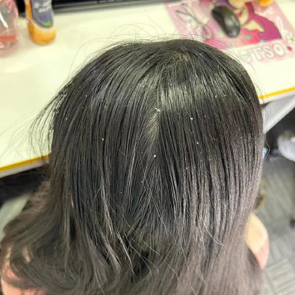 补哪款硒洗发水好呢(补水滋养洗发水)-硒宝网