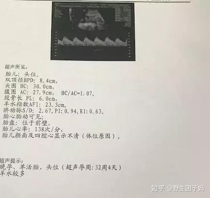 孕期几个月开始补铁（孕妇补铁时期）-硒宝网