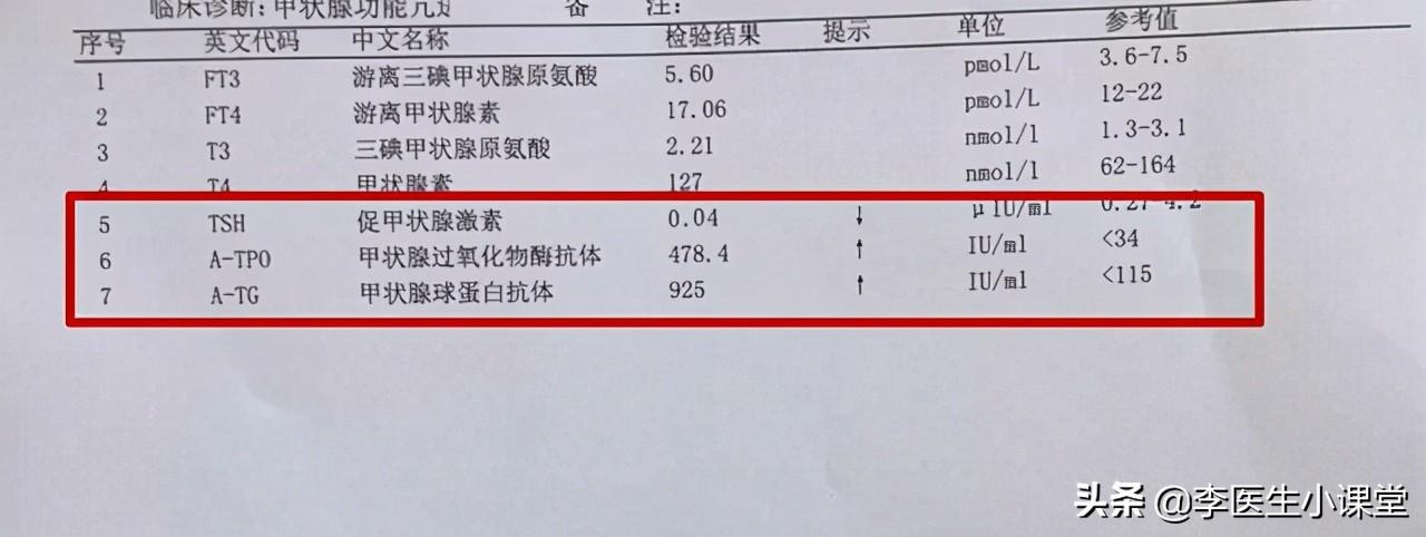 甲亢用补硒嘛有用吗(甲亢补硒能减少复发吗)-硒宝网