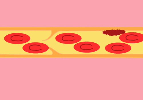 三高人群需要补硒吗（那种硒对三高有用）-硒宝网