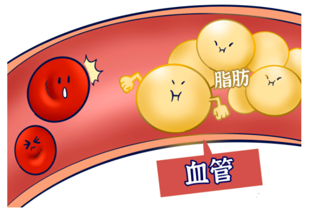 脂肪肝为什么要补硒(肝脂肪补硒要多久)-硒宝网