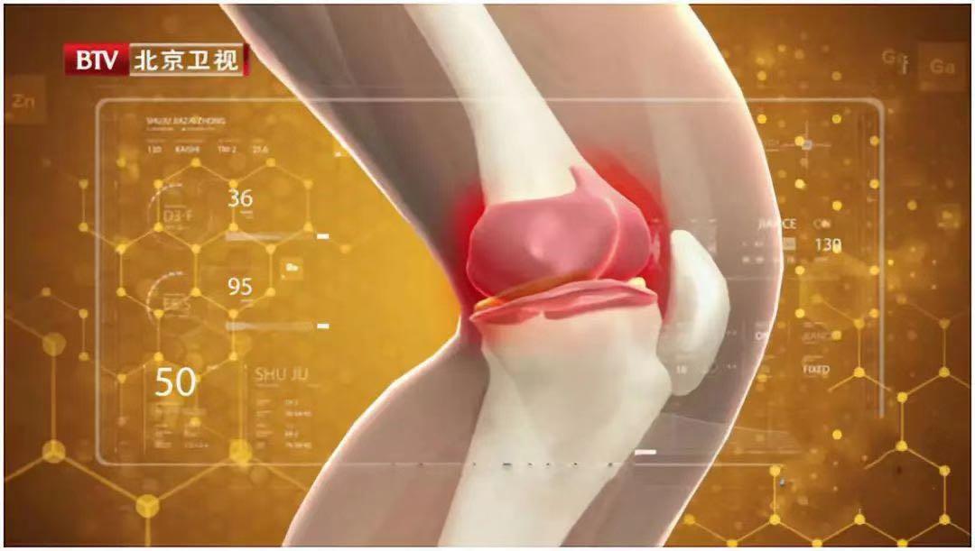 补硒能治疗关节炎吗(硒对关节炎疼痛的作用)-硒宝网