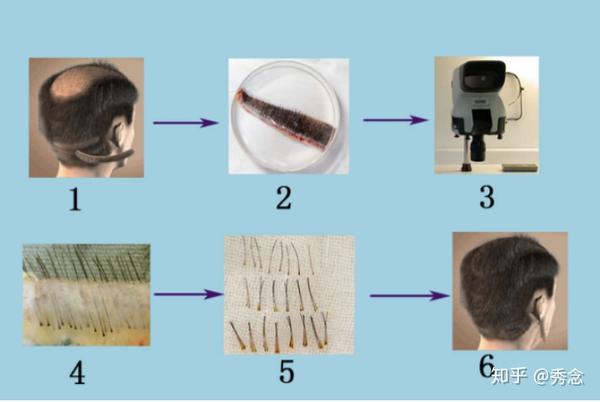 红斑狼疮能不能补硒（系统性红斑狼疮可以补硒吗）-硒宝网