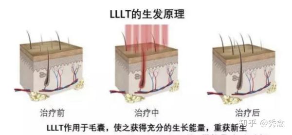 红斑狼疮能不能补硒（系统性红斑狼疮可以补硒吗）-硒宝网