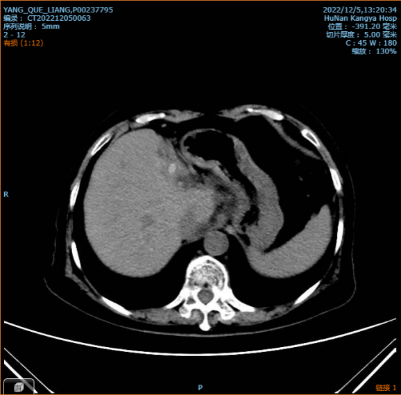 微创手术补硒有用吗(做手术后能吃硒片吗)-硒宝网