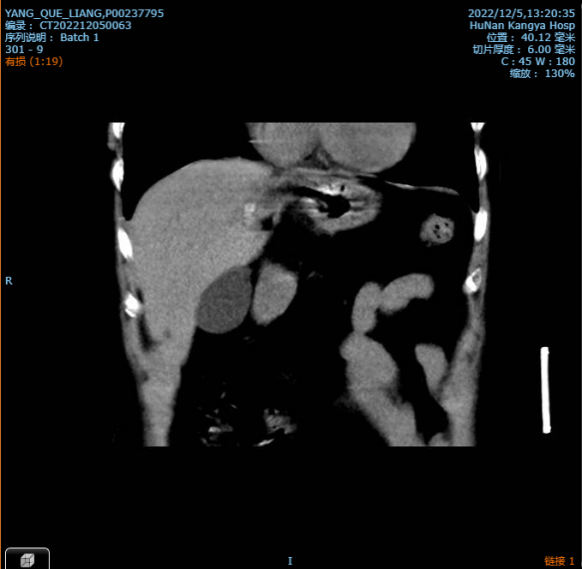 微创手术补硒有用吗(做手术后能吃硒片吗)-硒宝网