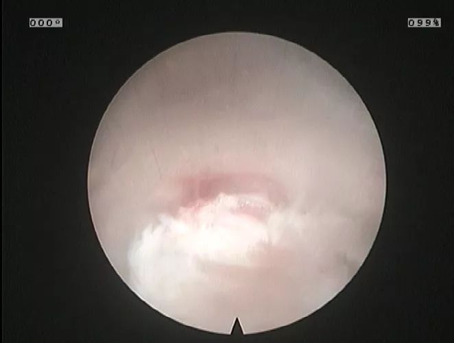 微创手术补硒有用吗(手术补微创硒用有什么好处)-硒宝网