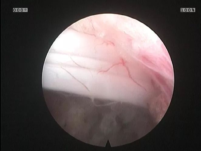 微创手术补硒有用吗(手术补微创硒用有什么好处)-硒宝网