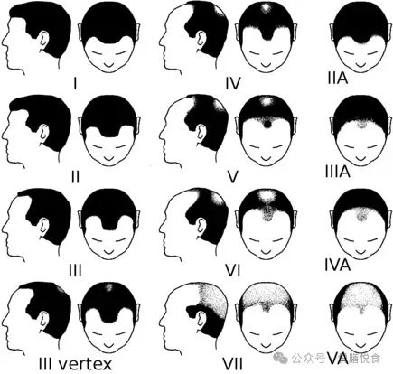 掉头发补硒有作用吗(脱发补硒)-硒宝网