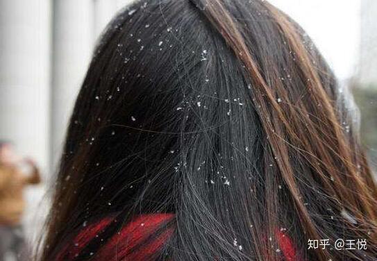 补硒与牛皮癣的治疗(牛皮肤癣吃什么西药)-硒宝网