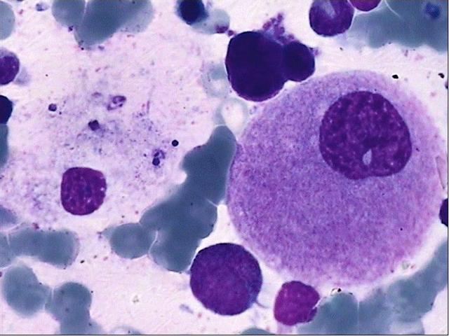 糖尿病患者如何补硒(糖尿病患者补硒有作用吗)-硒宝网