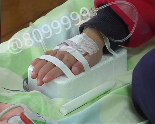 微量元素检查多少钱（微量元素检查多少钱有哪些项目）-硒宝网