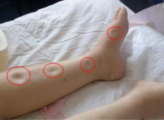 糖尿病患者如何补硒（补硒对糖尿病人有什么好处）-硒宝网