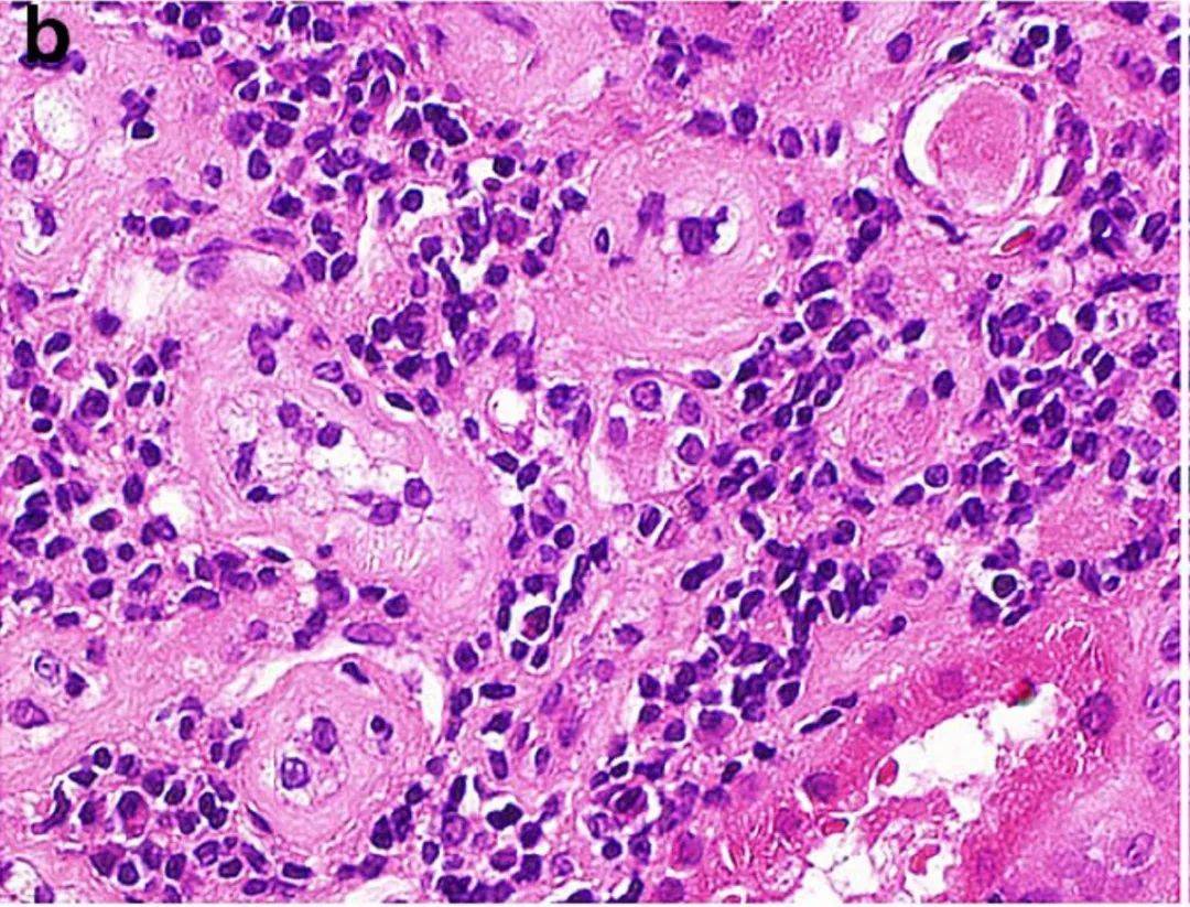 补硒排毒眼皮会肿吗（硒对眼睛）-硒宝网