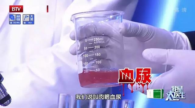 补硒排毒眼皮会肿吗（硒对眼睛）-硒宝网