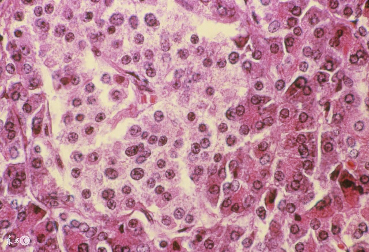 糖尿病患者如何补硒(糖尿病补硒)-硒宝网