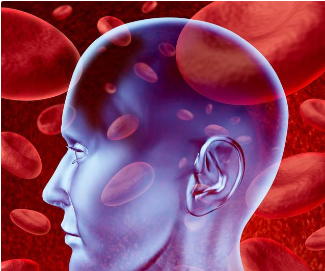 脑出血病人能补硒吗(出血脑病人能补硒元素吗)-硒宝网