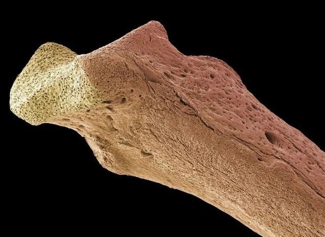 吃虾皮能补钙吗（能补钙虾皮吃的有哪些）-硒宝网