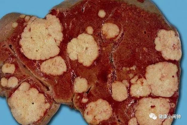 正常人能补麦芽硒么（麦芽硒健康人可以吃吗）-硒宝网