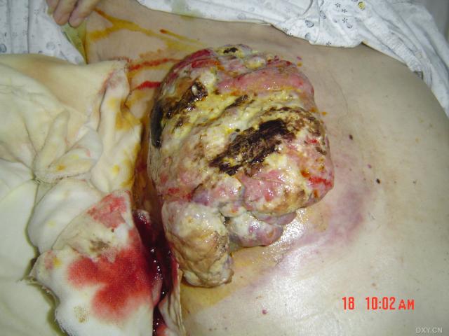 补硒可以生双胞胎吗（双胞胎补生硒可以吃多久）-硒宝网