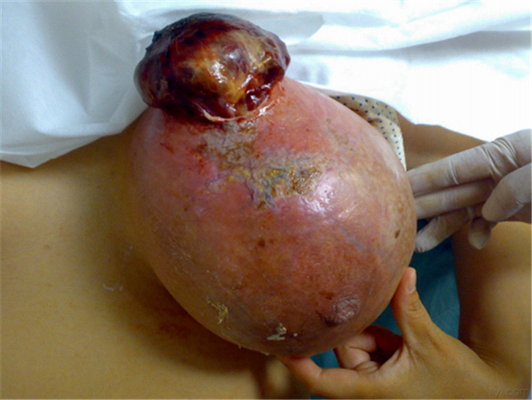 补硒可以生双胞胎吗（双胞胎补生硒可以吃多久）-硒宝网