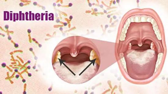 补硒影响打胰岛素吗(打胰岛素影响肾功能吗)-硒宝网