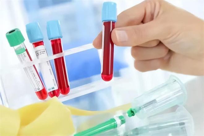 哪些食物能补钙(食物补钙排行)-硒宝网