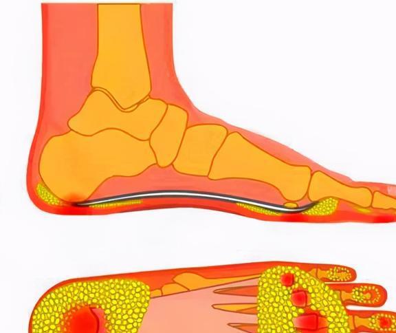 骨质增生要补钙吗（增生补钙骨质要吃多久）-硒宝网