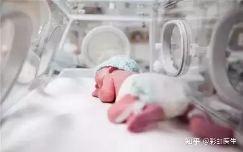 补铁是补血吗（补血补铁是饭前吃还是饭后）-硒宝网