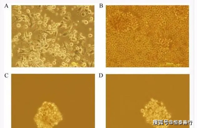 化疗时补硒有什么用(化疗补硒)-硒宝网