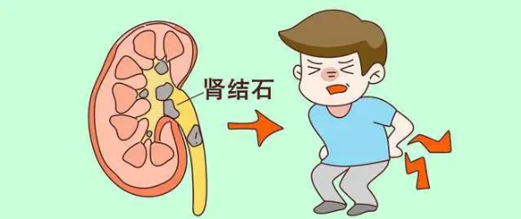 补钙过多(补钙过量有什么害处)-硒宝网