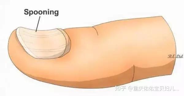 孩子缺微量元素怎么补（孩子缺少微量元素）-硒宝网