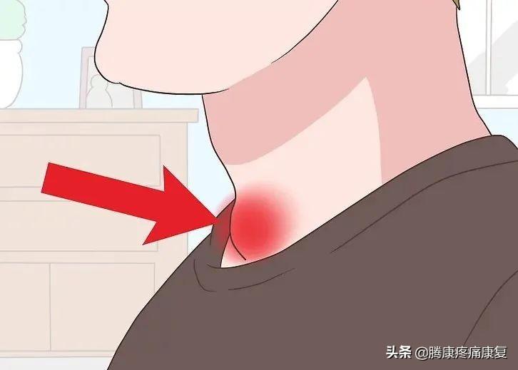 补硒可以治亚甲减吗（甲减吃硒）-硒宝网