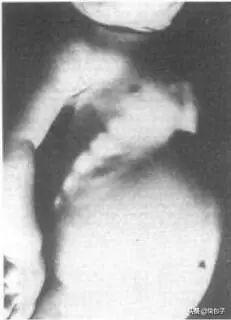 儿童补钙产品排行榜（1儿童补钙产品排行榜）-硒宝网