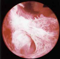 如何补铁(补铁的药有哪些)-硒宝网