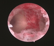 如何补铁(补铁的药有哪些)-硒宝网