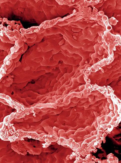 补硒能治疗皮肤病吗(硒皮肤病的克星)-硒宝网