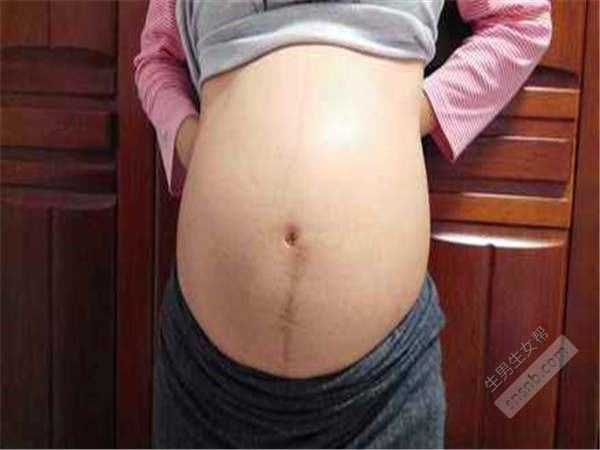 吃什么补钙快速又有效（补钙快速有效吃什么药）-硒宝网