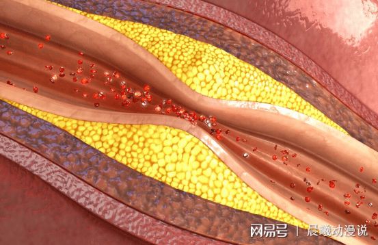 三高人群可以补硒么(补硒能降低三高吗)-硒宝网