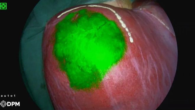 生活中哪些人要补硒(适当补硒)-硒宝网