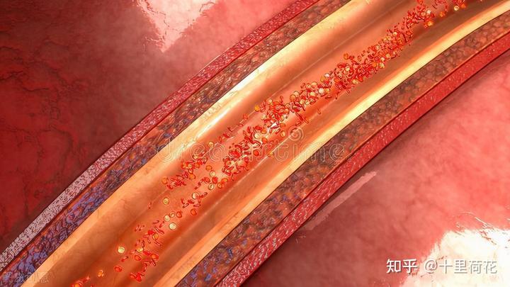 脑动脉瘤可以补硒吗(脑动脉瘤可以吃燕窝吗)-硒宝网