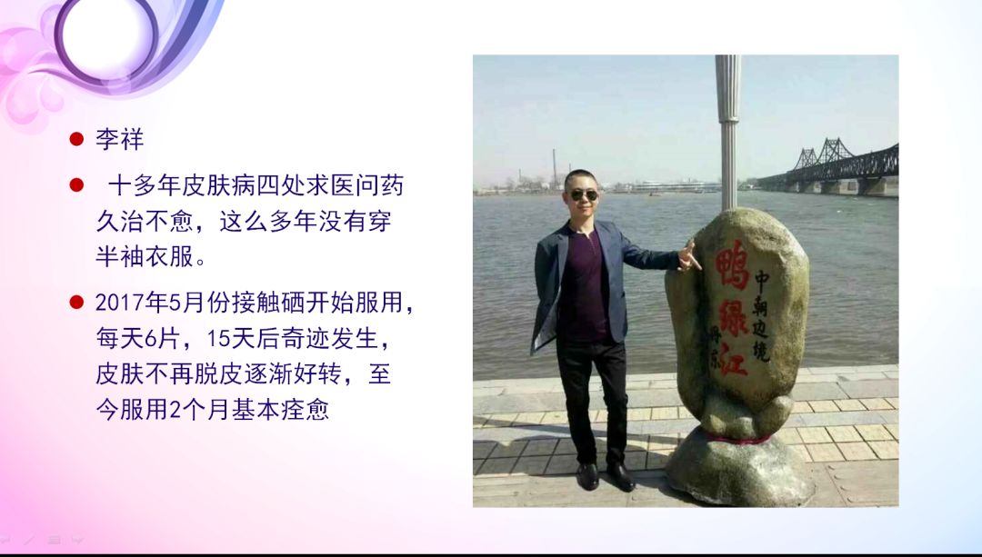 补硒对银屑病有用吗(补硒可以治疗银屑病吗)-硒宝网